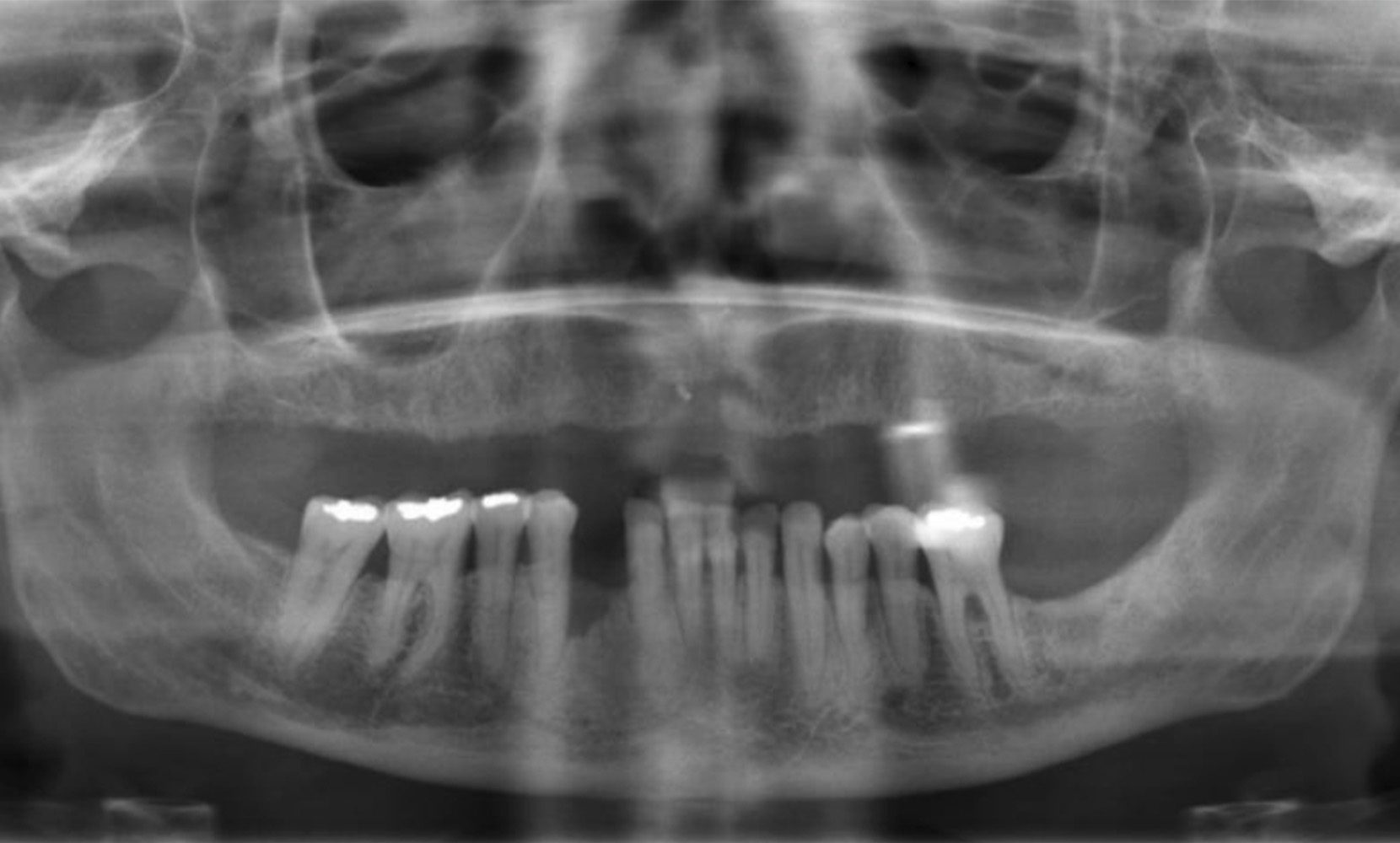Oral Medicine Penn Dental Medicine