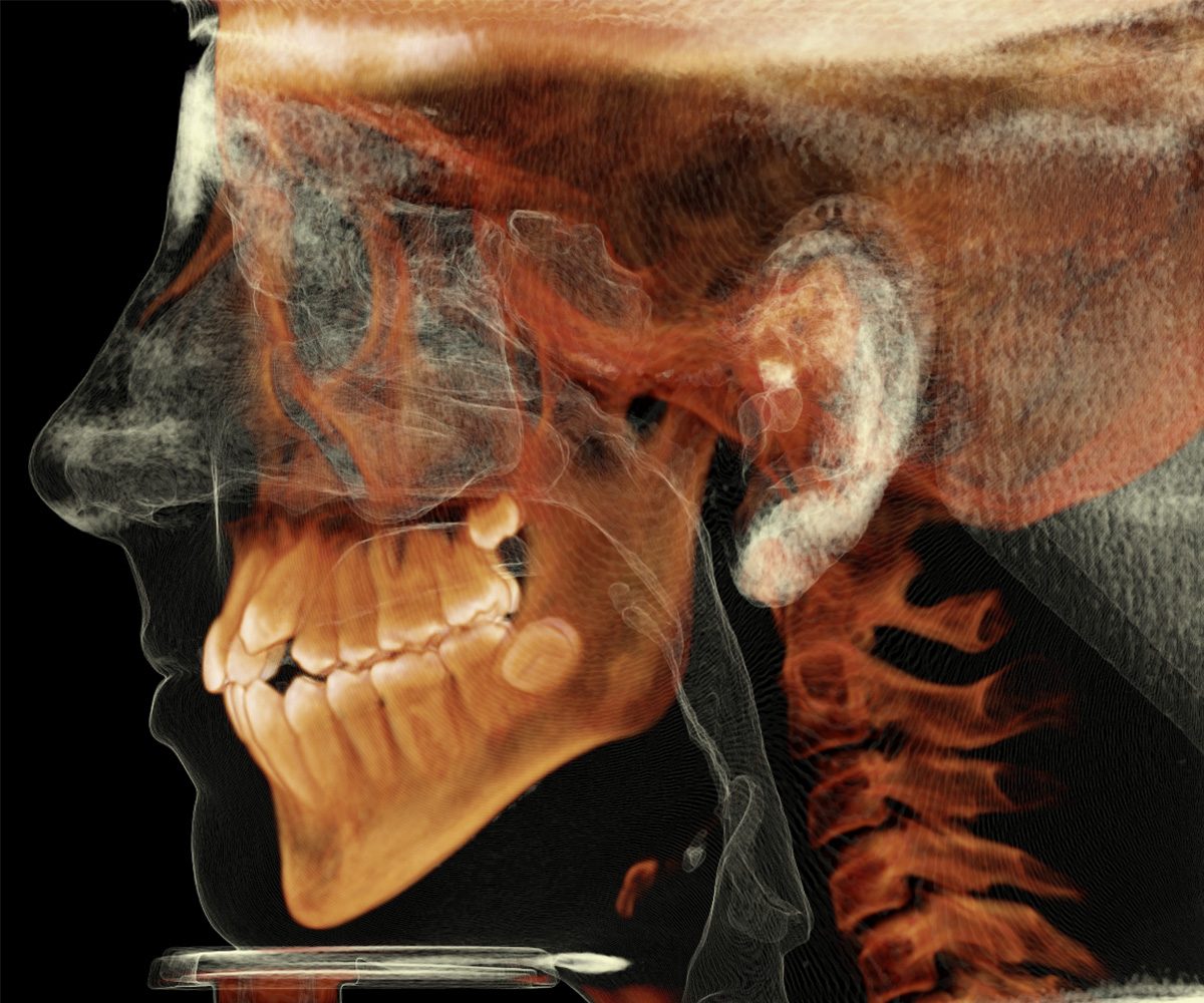 Orthodontics Penn Dental Medicine