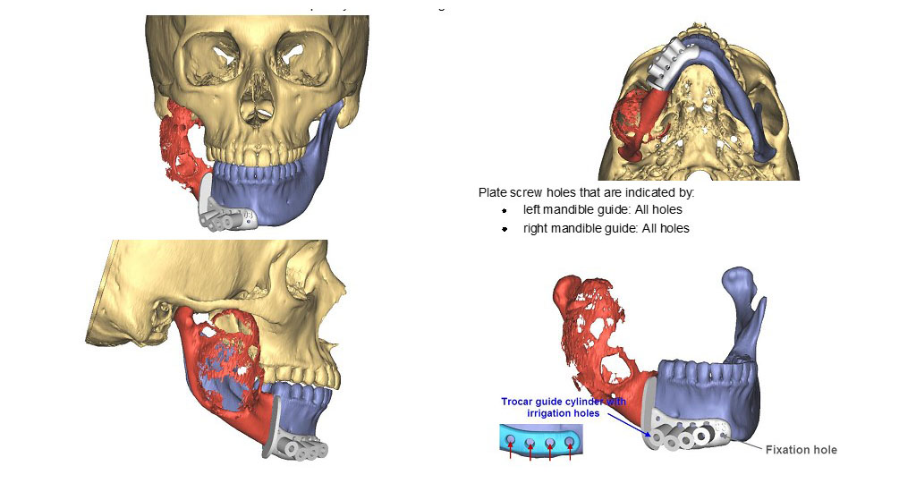 About Slide Image