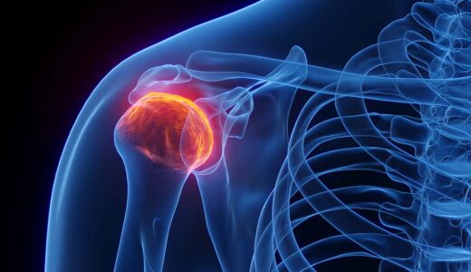 Dr. Sheri Yang, Collaborator Awarded $2.79M to Advance Study, Treatment of Rheumatoid Arthritis