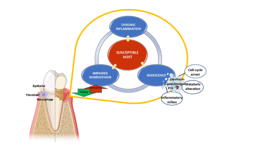 New Drug Therapy with Natural Compound Shows Promise Against Periodontal Diseases